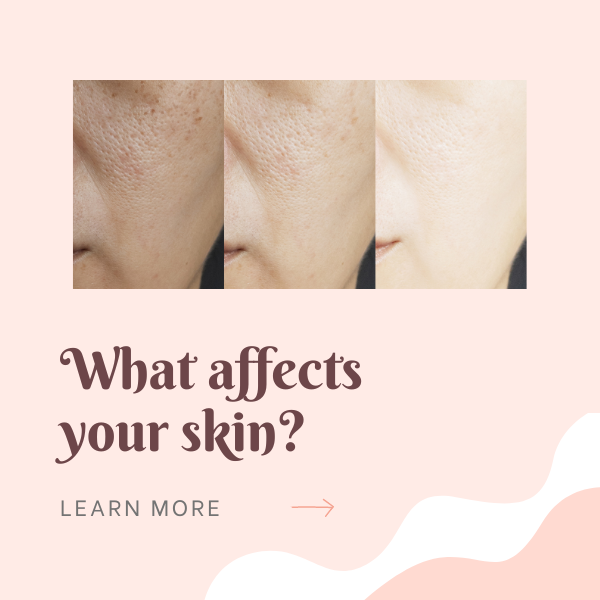 what factors affect your skin?